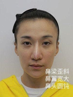 鼻樑起節女面相|男女鼻樑起節如竹：面相如何：這樣的面相應該注意什麼？